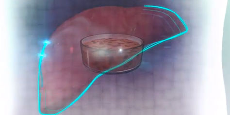Imagem de NovoGen MMX Bioprinter: a impressora 3D capaz de imprimir tecidos vivos no site TecMundo