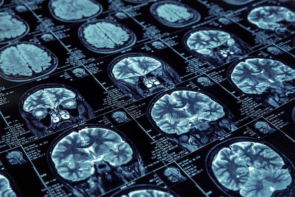 Imagem de Philips está desenvolvendo algoritmos e IAs para diagnosticar câncer no tecmundo